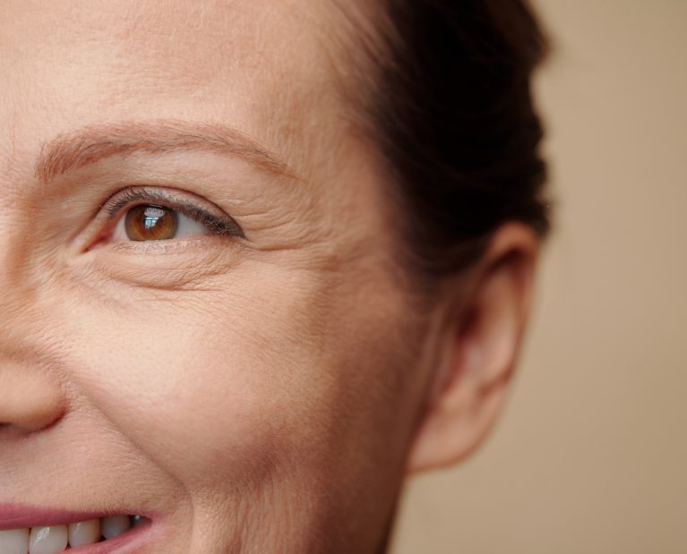 Eye Wrinkles Formation