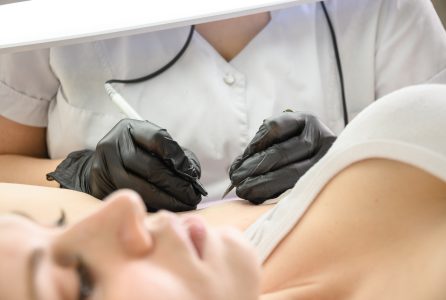 Procedure removal of hair permanently in a woman’s armpits using metod electro epilation. Close up. Procedure removal of hair permanently in a woman's armpits using metod electro epilation. Close up.