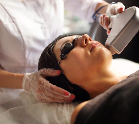 Woman on procedure of laser epilation Woman on procedure of laser epilation